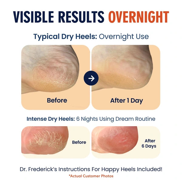 VelvetFeet™ - Moisturizing Gel Socks