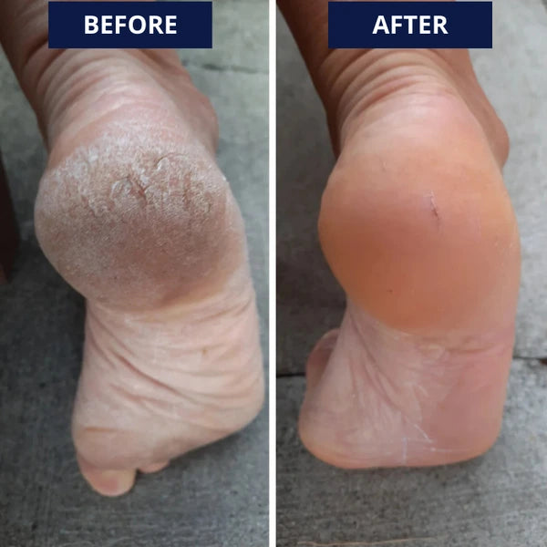 VelvetFeet™ - Moisturizing Gel Socks